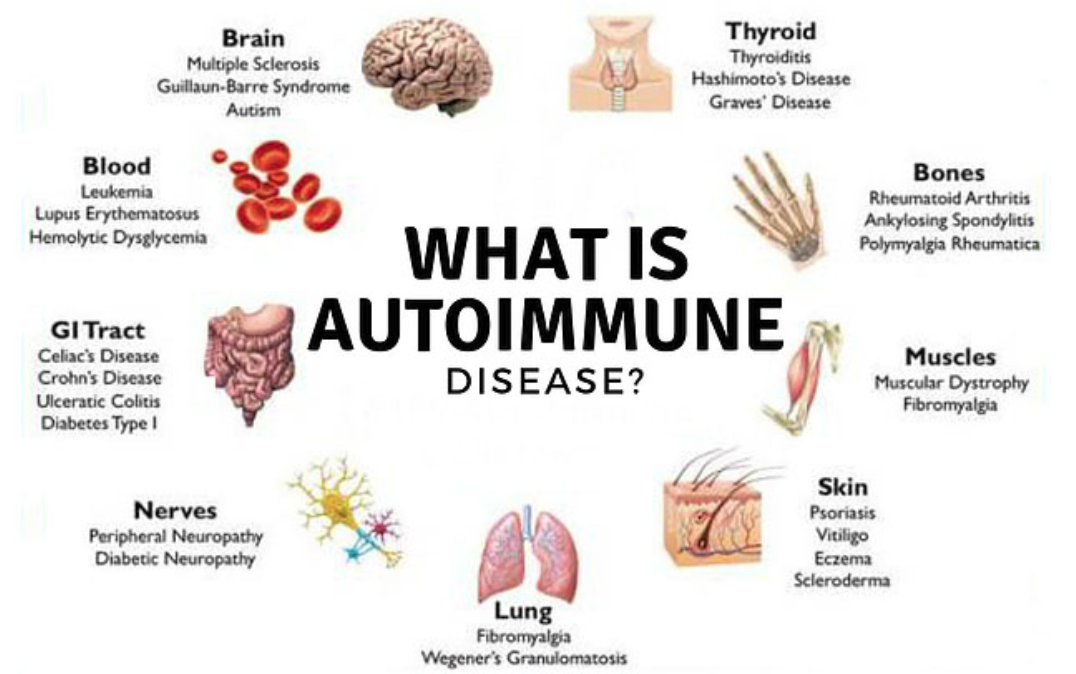 Autoimmune Diseases And Hyperbaric Oxygen