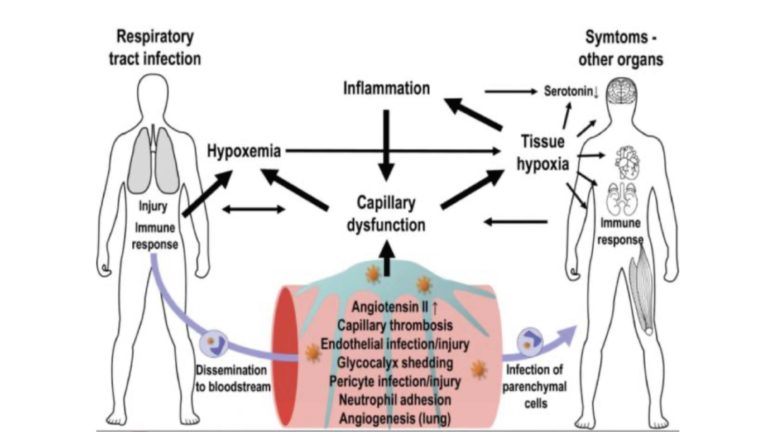 Hyperbaric Oxygen Therapy and COVID Long Haulers Syndrome